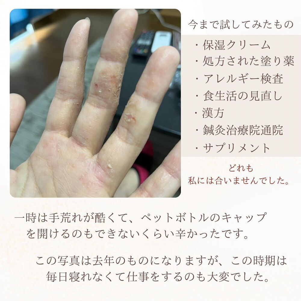 ブログ