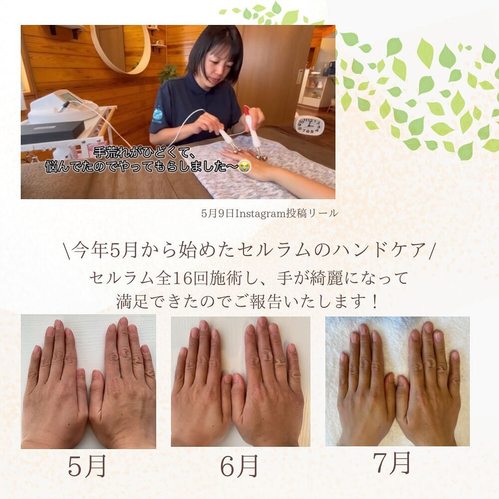 ブログ